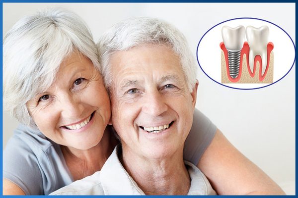 trồng răng implant tại tam kỳ